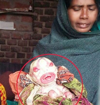 इस महिला ने एलियन जैसे बच्चे को दिया जन्म
